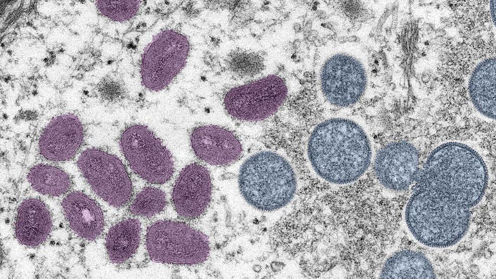 Monkeypox: First deaths outside Africa in Brazil and Spain By Malu Cursino