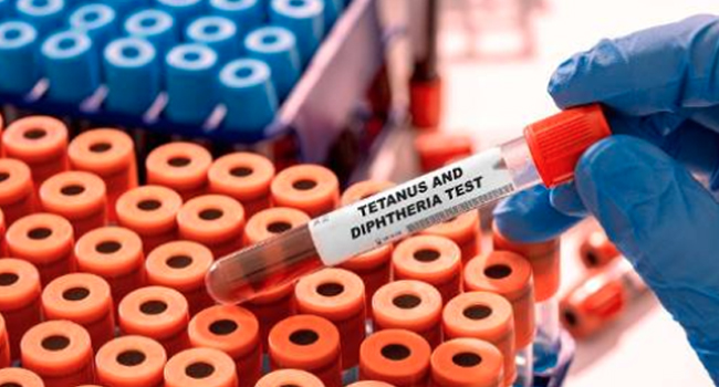 61 Die Of Diphtheria In Kano