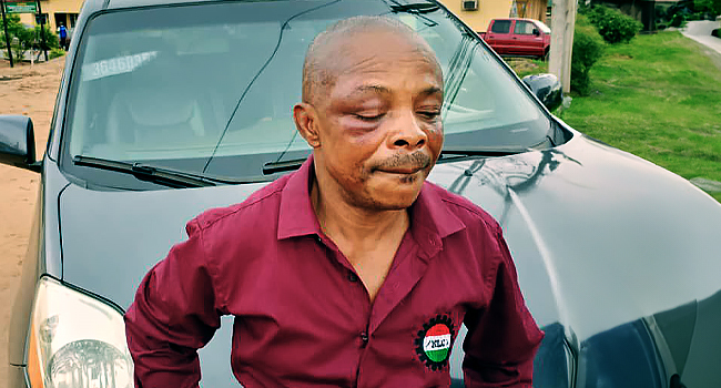 "˜I Can't Explain The Beating': NLC President Ajaero Narrates Ordeal In Imo