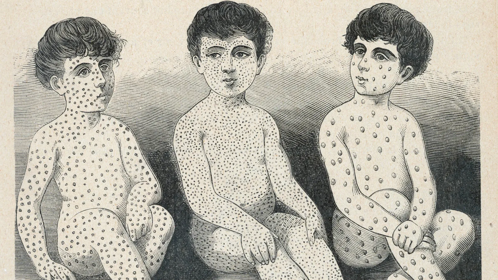 The race to understand 'immune amnesia'