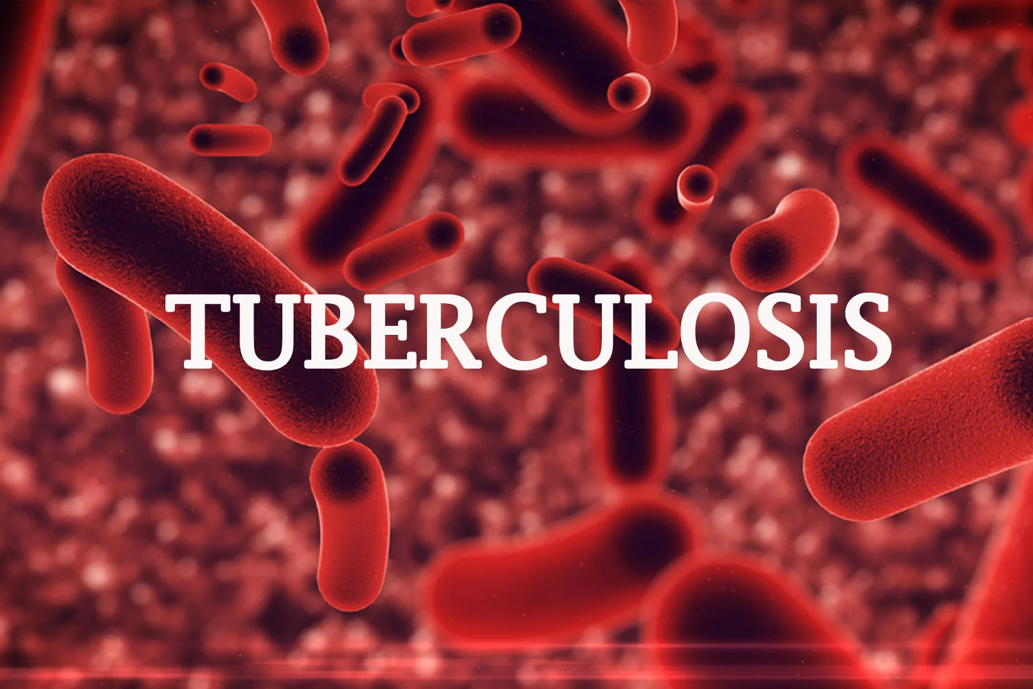 Tuberculosis: Don't sleep in same room with others "“ Expert to patients